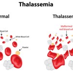 Xét nghiệm di truyền - Thalassemia