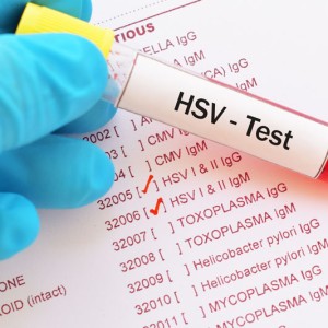 Sàng lọc bệnh phụ khoa HSV PCR (Herpes simplex virus)
