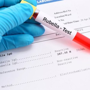 Sàng lọc bệnh phụ khoa Rubella (PCR)