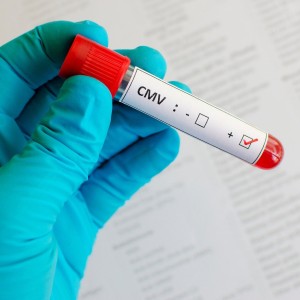 Sàng lọc bệnh phụ khoa CMV (PCR)