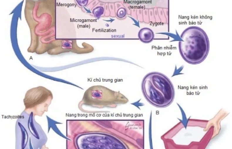 Sàng lọc bệnh phụ khoa Toxoplasma (PCR)